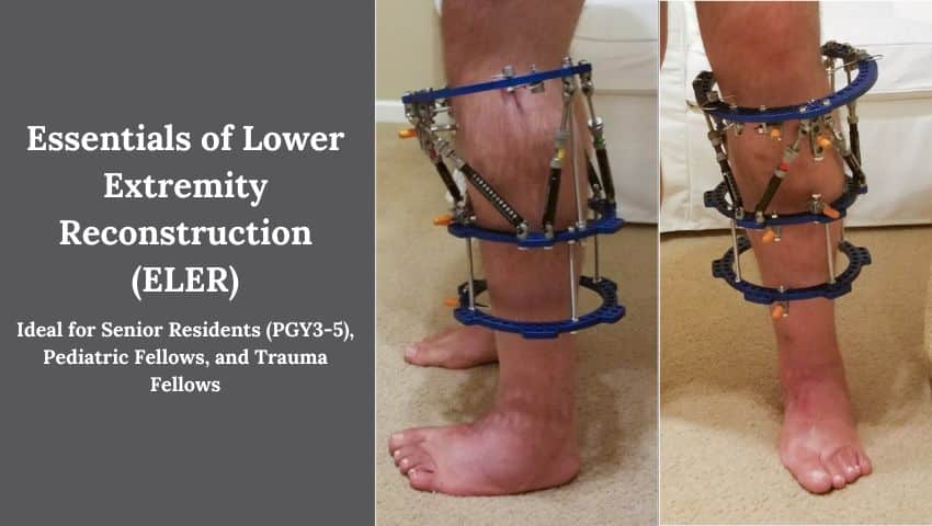 Essentials of Lower Extremity Reconstruction (ELER)
